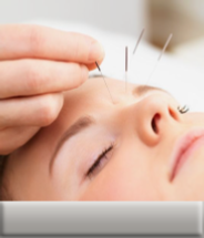 Acupuncture